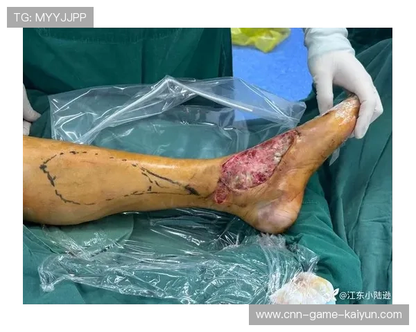 姆巴佩内切后起脚 姆巴佩内切后起脚